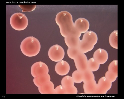 klebsiella on endo